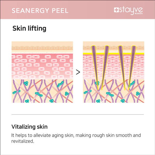 Stayve Seanergy Peel – Professional Skin Exfoliation & Brightening Treatment - Image 11