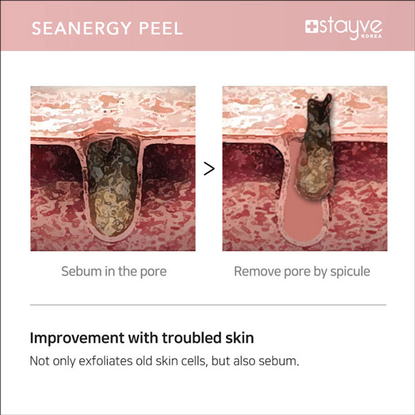 Stayve Seanergy Peel – Professional Skin Exfoliation & Brightening Treatment - Image 10