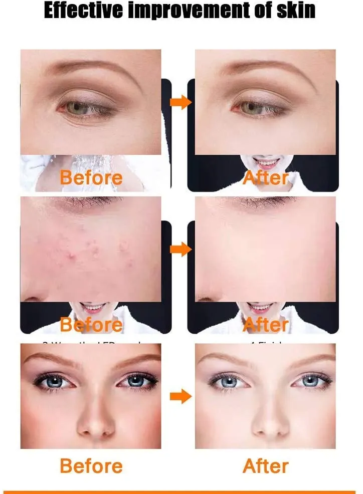 LED Face Mask 3 Color Photon Skin Care Mask SMASK - Image 6