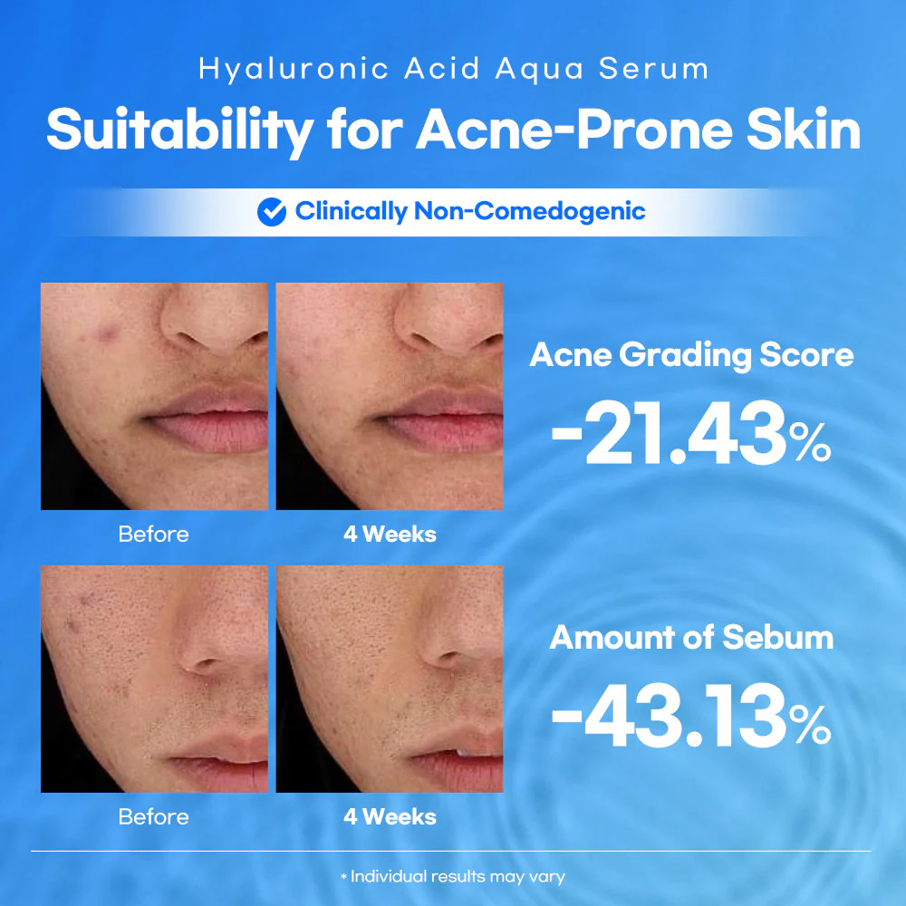 Lesimo Hyaluronic Acid Aqua Serum 50ml - Hydrating, Moisture Serum, Concentrated Anti-Aging Moisturizer for Dry LHAAS - Image 4